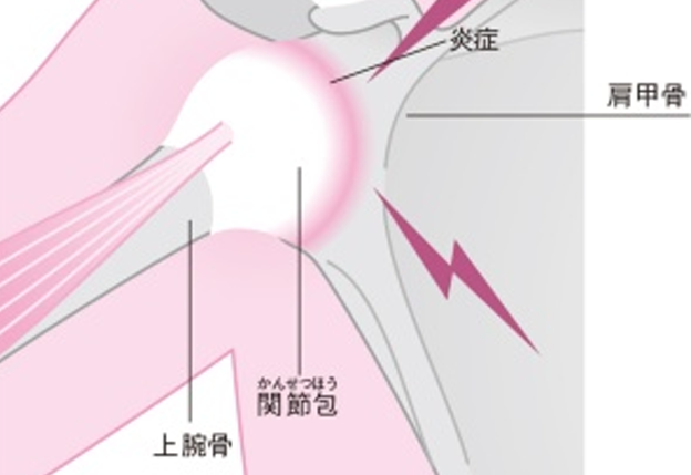 四十肩・五十肩 四十肩・五十肩